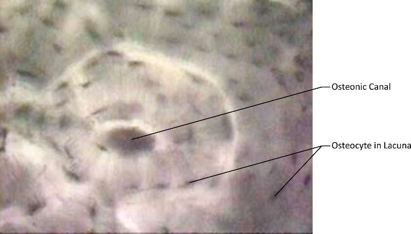 Bone micrograph
